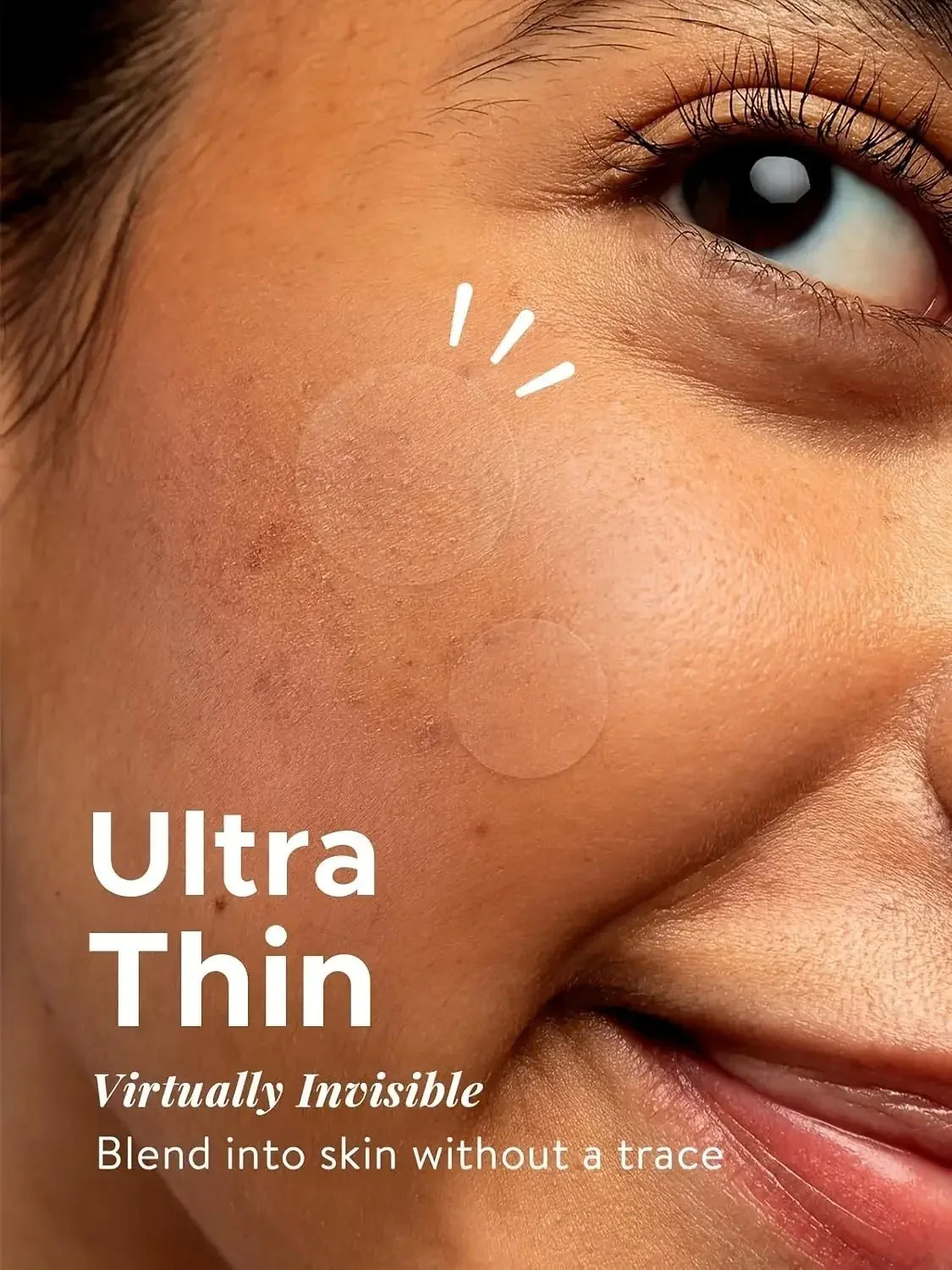 Parches invisibles para granos · 360 unidades